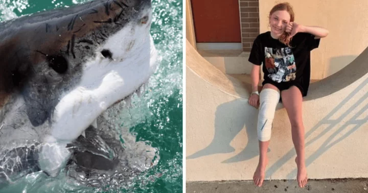 Who is Magnolia Woodhead? Girl survives miraculously as shark attack in Florida leaves 100 bite marks on her leg